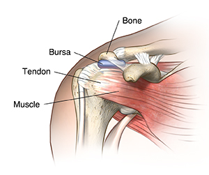 Front view of shoulder showing bones, ligaments, tendons, and bursa.