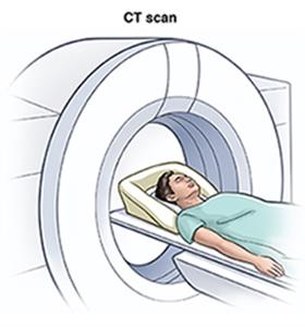 CT scan