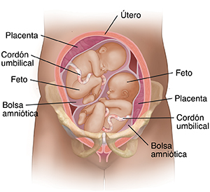 Vista frontal de un corte transversal de un útero en los huesos pélvicos de una mujer embarazada donde se observan dos fetos.